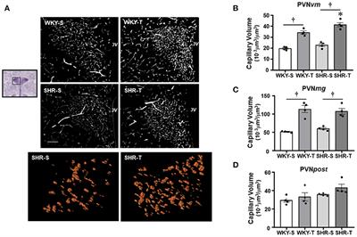 Perfusion of Brain Preautonomic Areas in Hypertension: Compensatory Absence of Capillary Rarefaction and Protective Effects of Exercise Training